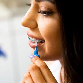 Young woman using interdental brush to clean around her braces
