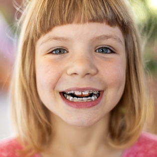 young girl wearing retainer