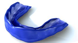 Blue mouthguard prior to placement