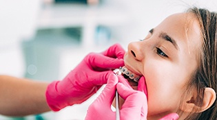 A little girl having her braces and teeth examined during a visit to see her orthodontist