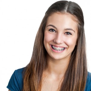 girl with braces smiling