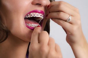 woman smiling braces flossing