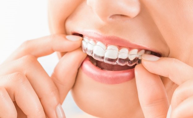 Woman removing her clear aligners.