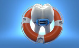 Illustration of a tooth with braces inside a lifesaver